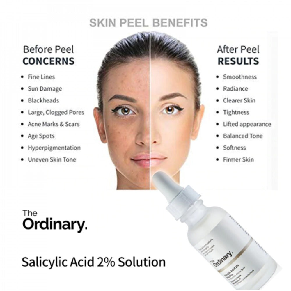 The Ordinary Niacinamide Serum (MADE IN USA)