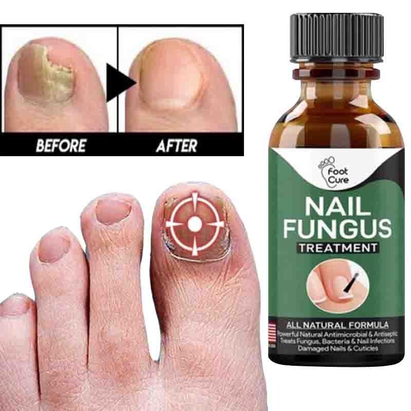 Nail Fungus Serum (MADE IN USA)